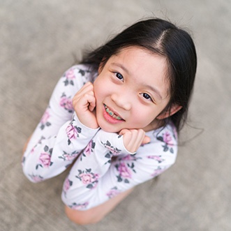 early orthodontic treatment